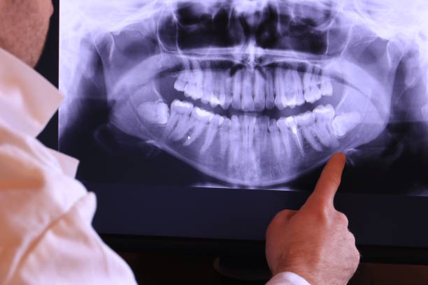 Best Urgent Dental Care for Toothaches in Soulsbyville, CA
