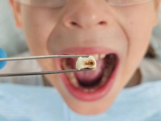 Best Weekend Emergency Dental Services in Soulsbyville, CA